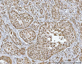 Anti-TRMT10C Antibody