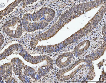 Anti-TRMT10C Antibody