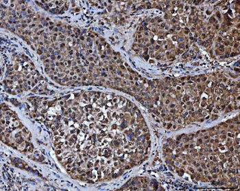 Anti-TRMT10C Antibody