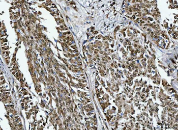 Anti-TRMT10C Antibody