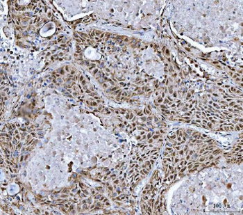 Anti-TRMT10C Antibody