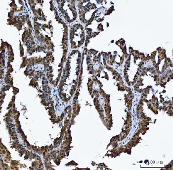 TRMT10C Antibody