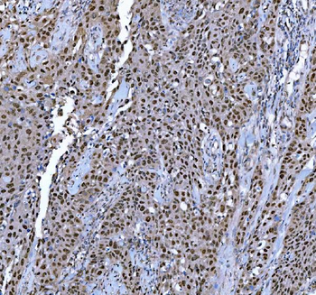 Anti-TRMT6 Antibody