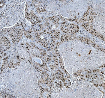 Anti-TRMT6 Antibody