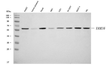 Anti-TRMT6 Antibody