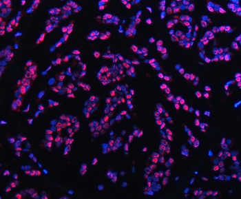 Anti-TRMT6 Antibody