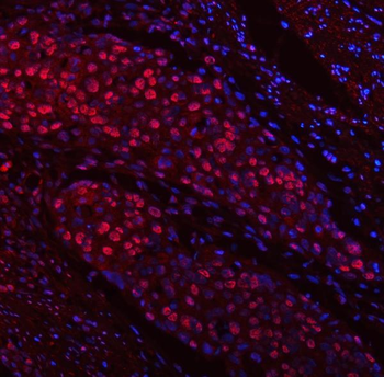 Anti-TRMT6 Antibody