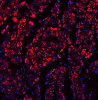 Anti-TRMT6 Antibody