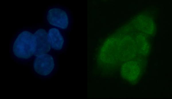 Anti-TRMT6 Antibody
