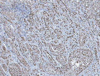 Anti-TRMT6 Antibody
