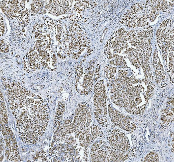 Anti-TRMT6 Antibody