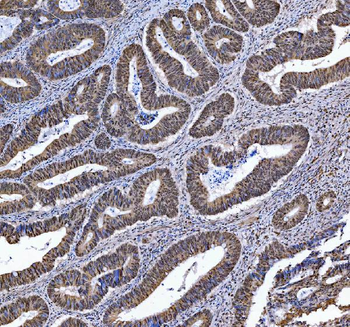 Anti-TRMT6 Antibody