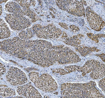Anti-TRMT6 Antibody