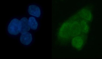 TRMT6 Antibody
