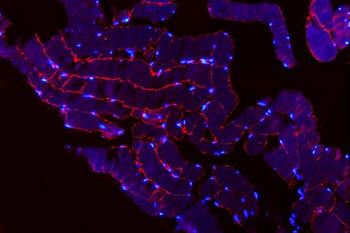 Anti-MG53/TRIM72 Antibody