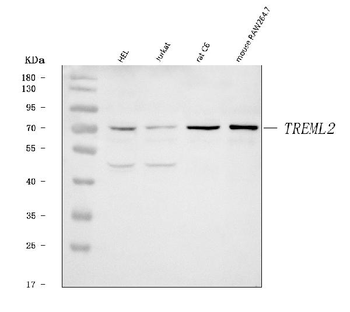 Anti-TREML2 Antibody