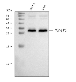 Anti-TRAT1 Antibody