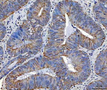 Anti-TRAM1L1 Antibody