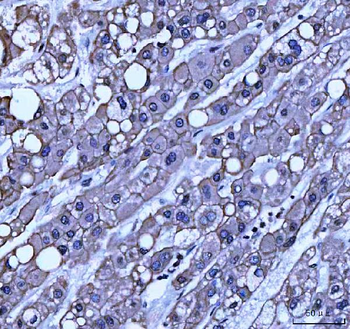 Anti-TRAM1L1 Antibody