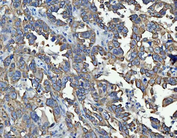 Anti-TRAM1L1 Antibody