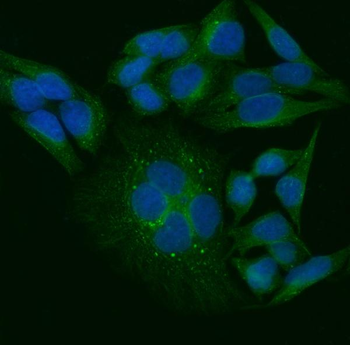 Anti-TRIP/TRAIP Antibody