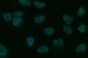 Anti-Tripeptidyl peptidase II/TPPII/TPP2 Antibody