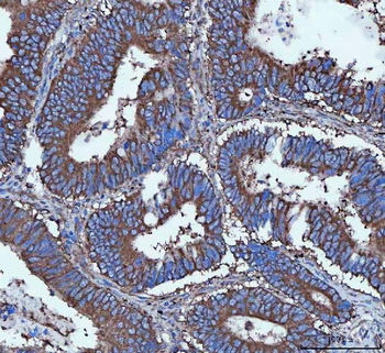 Anti-Tripeptidyl peptidase II/TPPII/TPP2 Antibody