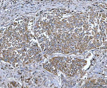 Anti-Tripeptidyl peptidase II/TPPII/TPP2 Antibody