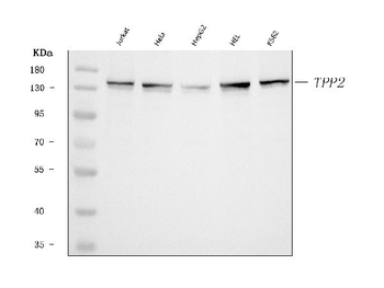 Anti-Tripeptidyl peptidase II/TPPII/TPP2 Antibody