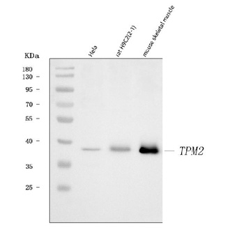 Tropomyosin 2/TPM2 Antibody