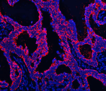 Anti-TMPRSS13 Antibody
