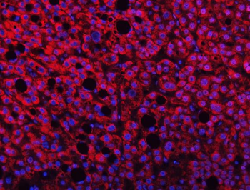 Anti-TMPRSS13 Antibody