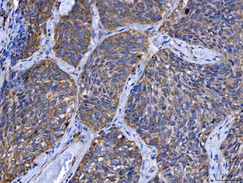 Anti-TMPRSS13 Antibody