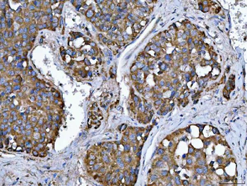 Anti-TMPRSS13 Antibody
