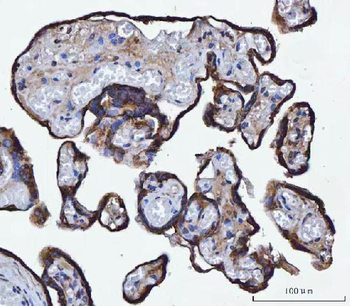 Anti-TMPRSS13 Antibody