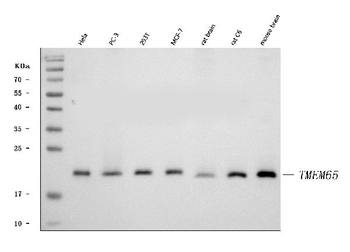 Anti-TMEM65 Antibody