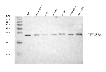 Anti-TMEM52B Antibody