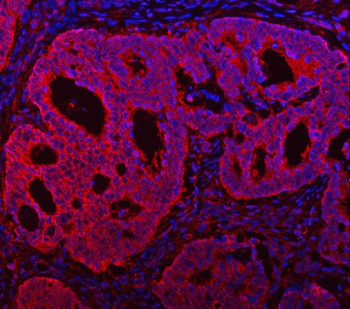 Anti-TMC7 Antibody