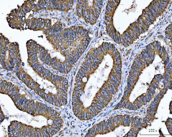 Anti-TMC7 Antibody