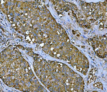 Anti-TMC7 Antibody