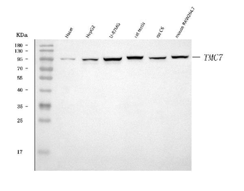 Anti-TMC7 Antibody