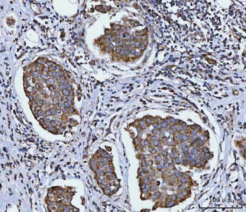 Anti-SIRT5 Antibody