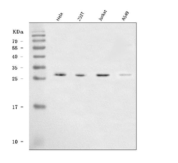 Anti-SAP30 Antibody