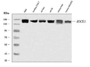 Anti-ROCK1 Antibody
