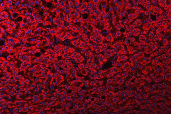 Anti-FRY Antibody