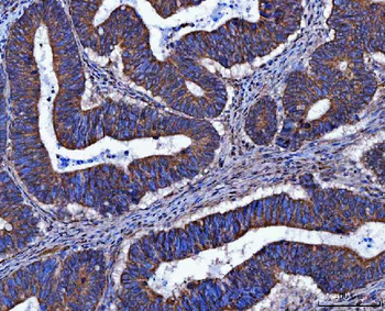 Anti-FRY Antibody