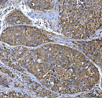Anti-FRY Antibody