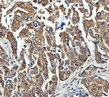 Anti-FRY Antibody