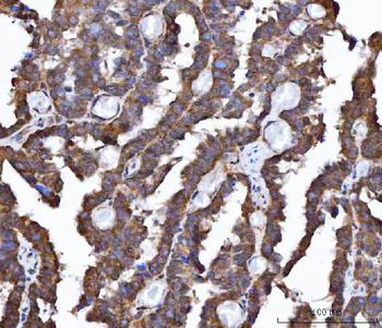 Anti-FRY Antibody