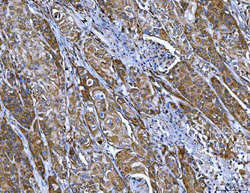 Anti-FRY Antibody